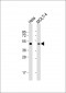 MAP2K2 Antibody (T394)